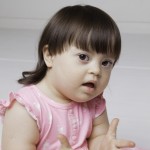 Bebê com síndrome de Down com mais de 36 meses.