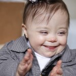 Bebê com síndrome de Down com 3 a 6 meses.