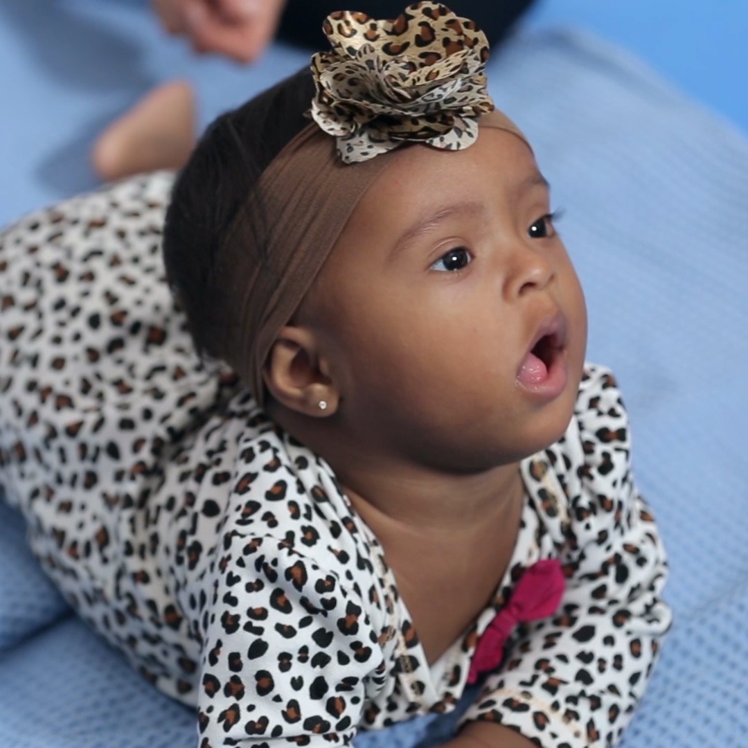 Lunna é uma bebê com síndrome de Down. Na foto, ela aparece em cima de um tapete onde faz exercícios de estimulação.