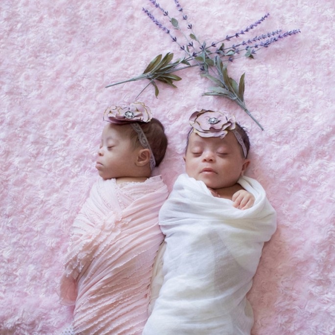 Fotógrafa registra imagens preciosas de gêmeas com síndrome de Down
